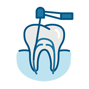 Gentle Endo Icons 0123 Root Canal Therapy